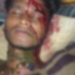 घर में घुसकर परिवार पर हमला, टांगिया-रापा और लाठी से मारपीट